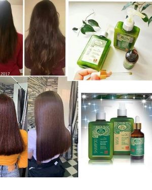 Bio Rehab Shampoo Hair Growth Activator.    ◼9.9 POINTS