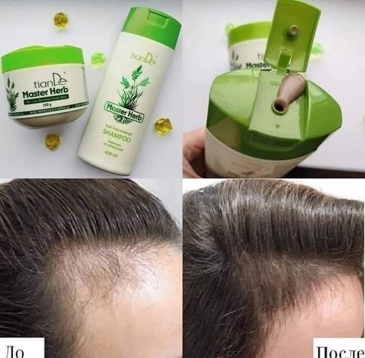 Master Herb Hair-Loss Reversal Cream Balm.   ◼11 POINTS