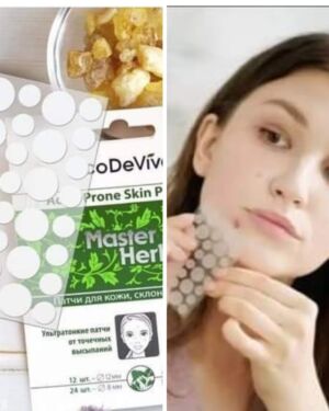 Acne-Prone Skin Patches,36pcs SKU: 38811